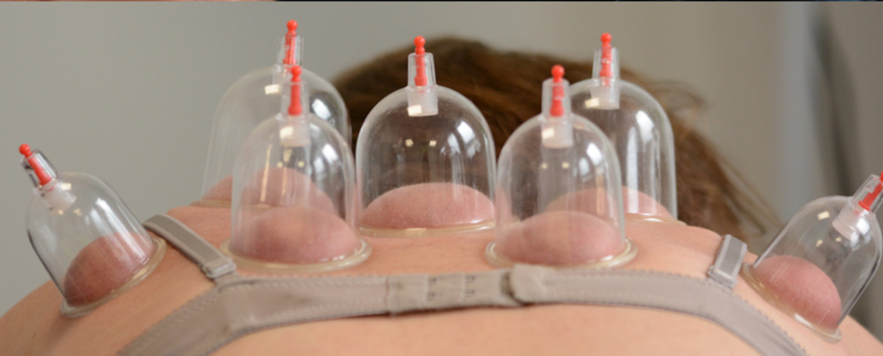 Cupping